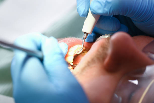 Best Urgent Dental Care for Toothache in Denmark, SC